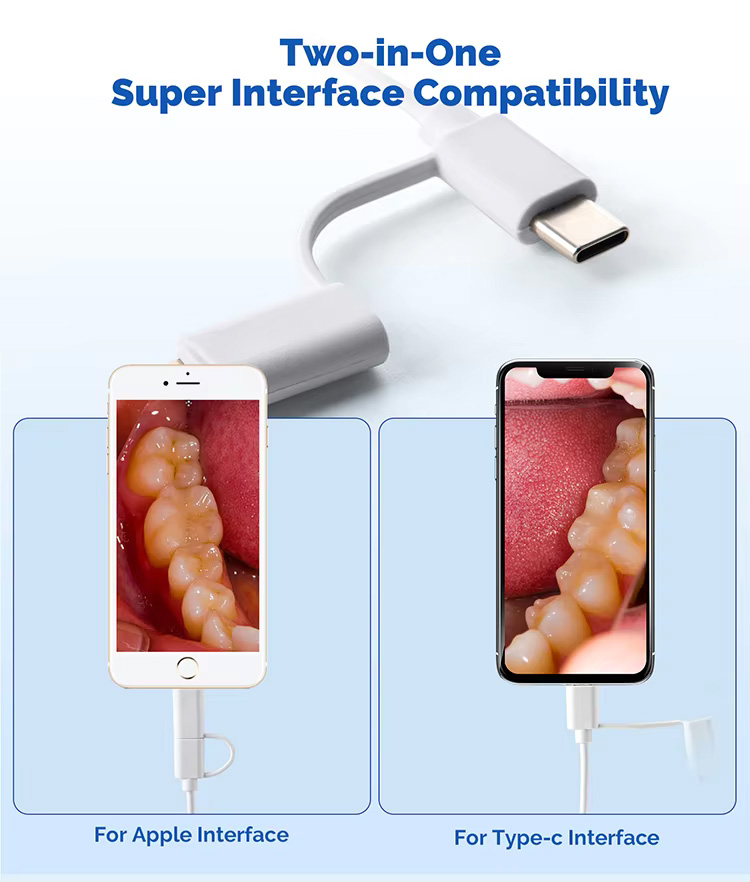 Dental Digital Intraoral Camera Type-C /Micro USB 2in1, 2.0MP Pixel